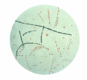 Bacillus anthracis wat miltvuur veroorsaak.
